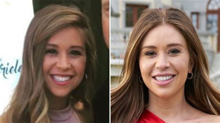 Did Gabby Windey From The Bachelorette Get Plastic Surgery? Here Are Before And After Pictures