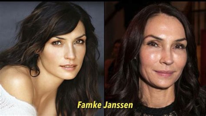 Famke Janssen Plastic Surgery Update- What Happened To The Actress?
