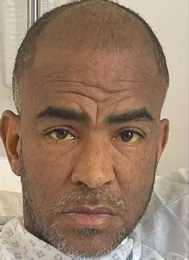 
Kieron Dyer Yellow Eyes Is Due To His Illness, Health Update 2022 On The Ex U23s Soccer Manager 
