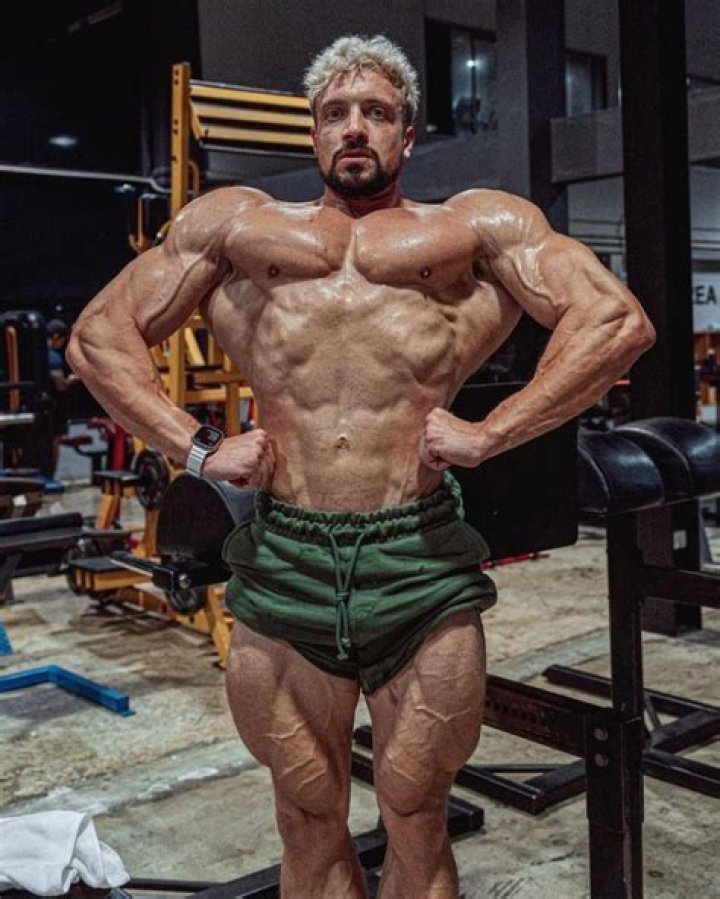 
What causes an aneurysm? Jo Lindner cause of death and symptoms explored as bodybuilder dies aged 30 